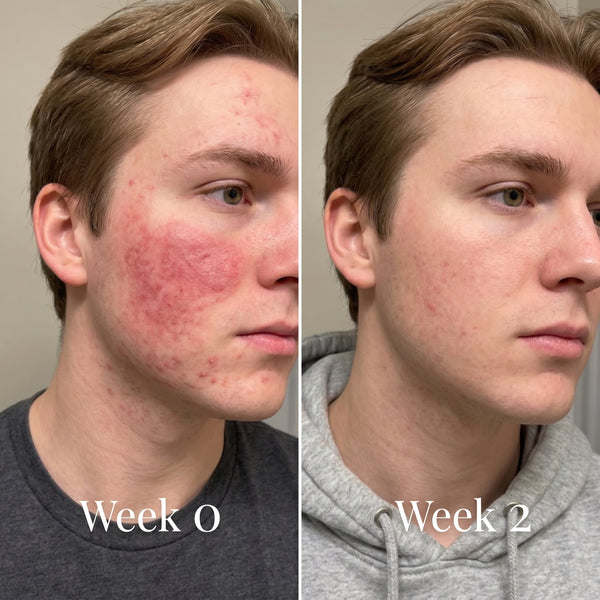 Glow Light Face & Neck Mask